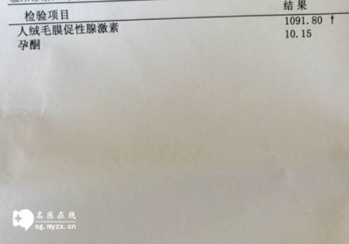 广州试管婴儿价格：吃叶酸并不能提高生双胞胎的几率，不妨试试这些方法